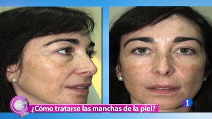 +Gente - Tratamientos para la piel