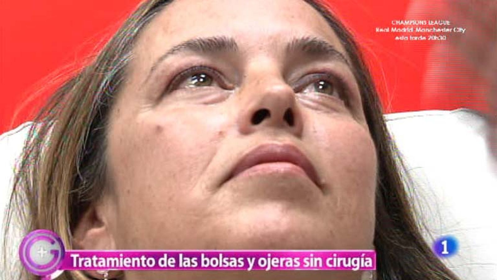 Más Gente - Tratamiento para reducir las ojeras sin agujas ni cirugía