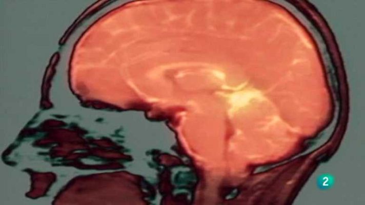 La noche temática - La plasticidad del cerebro