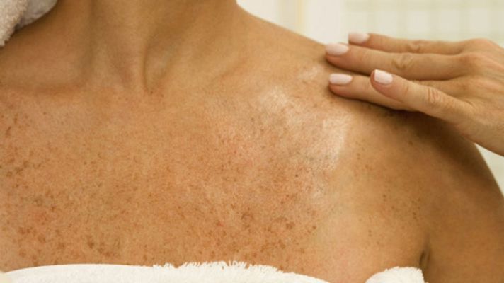 La mañana - Cuida bien tu piel