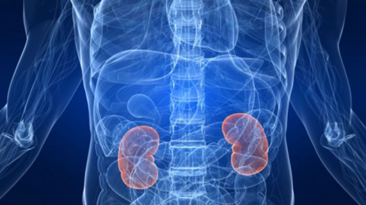 La mañana - Cálculos o piedras