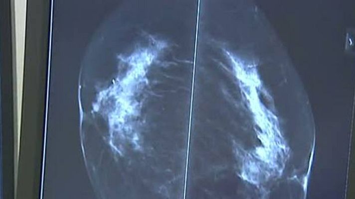 Telediario 1 - Embarazada y con cáncer