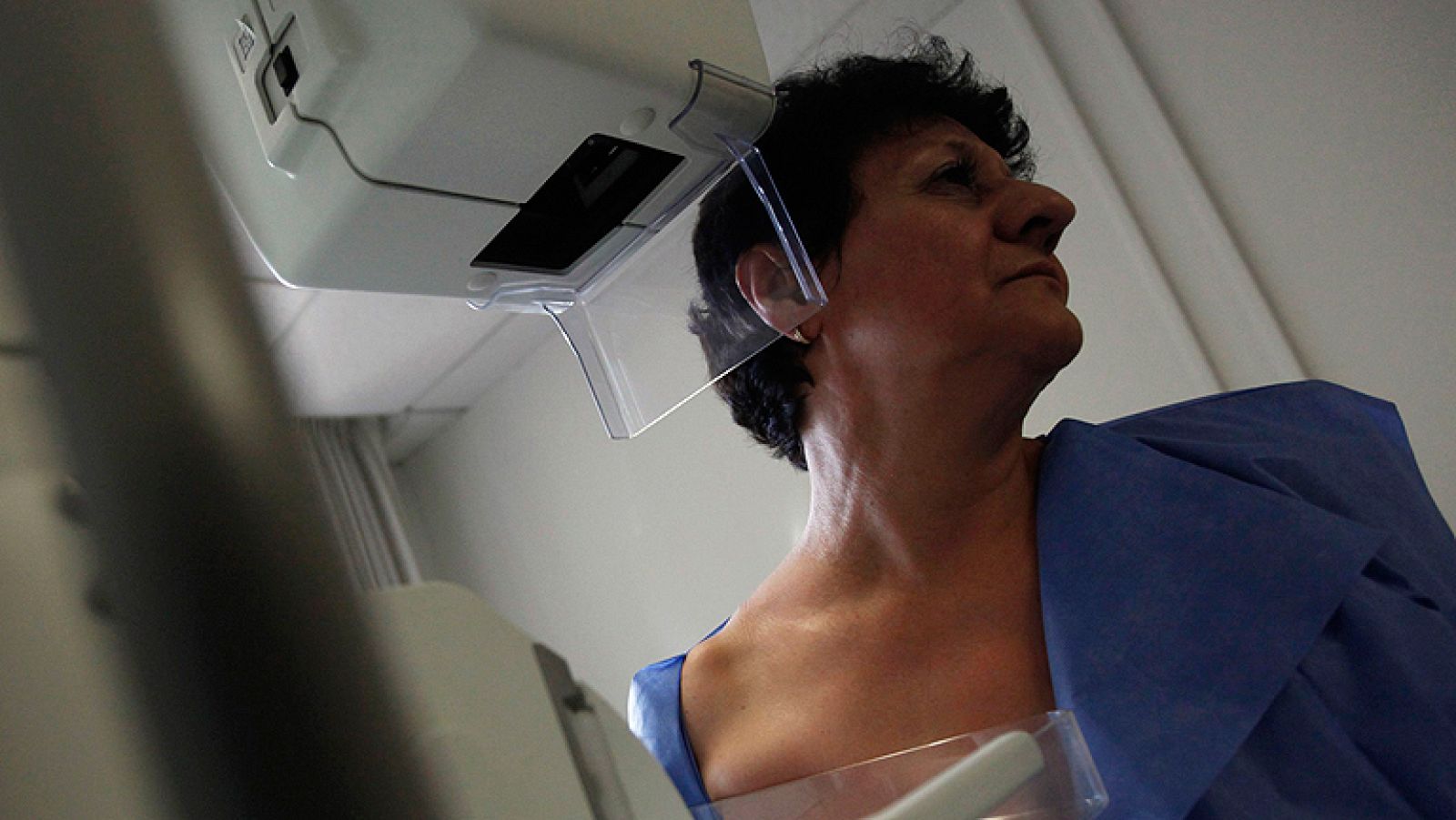 El índice de supervivencia de las mujeres que padecen cáncer de mama es del 85% - Informativo 24h | Ver