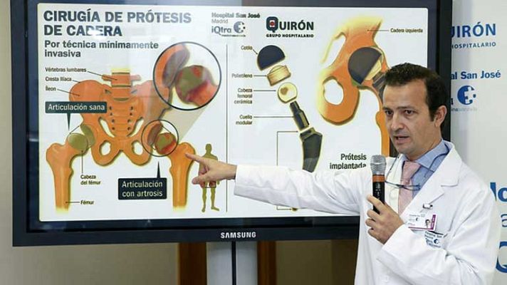 Telediario 1 - Telediario 1 en 4' - 24/11/12