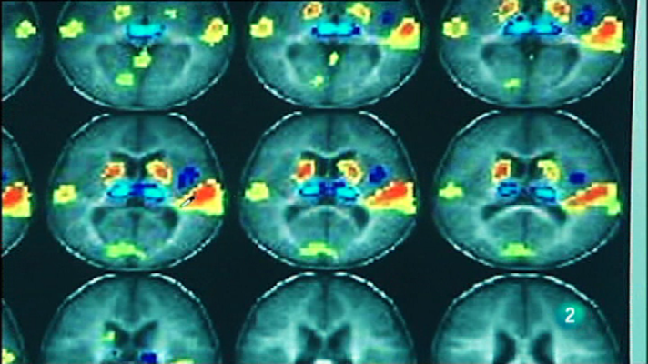 Fábrica de ideas - Innova: Instituto de Neurociencias