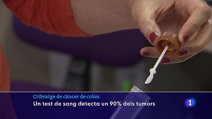 L'Informatiu - Un test de sang detecta un 90% dels tumors de còlon i recte