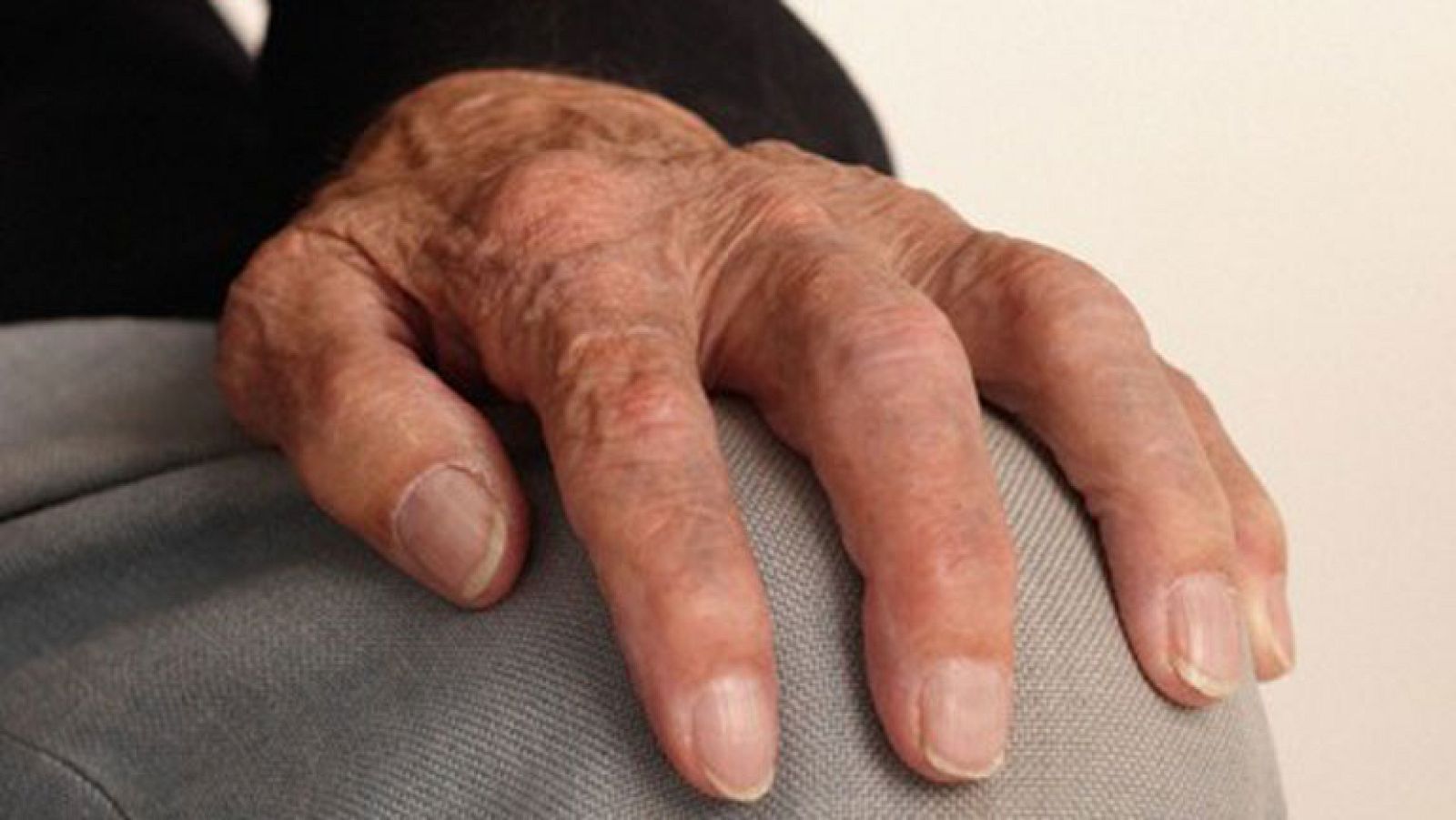 Saber vivir - Dolor reumático en otoño - Ver ahora