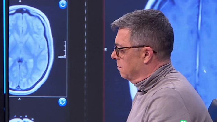 La aventura del Saber - La Esclerosis Lateral Amiotrófica. ELA