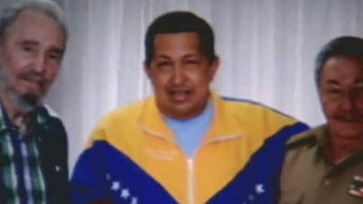 Telediario 1 - La salud de Hugo Chávez