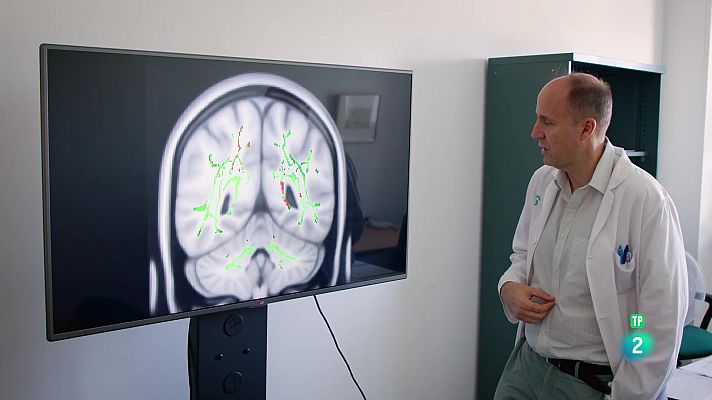 La aventura del Saber - Universo Sostenible. Covid persistente