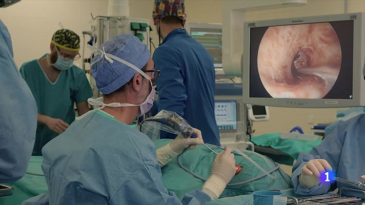 L'Informatiu - El Clínic, pioner a extirpar un tumor benigne d'oïde a través de cirurgia endoscòpica