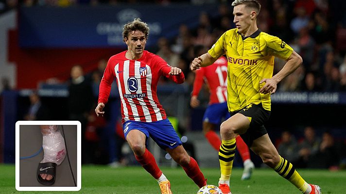 Champions League - Griezmann acabó con el tobillo tocado tras jugar los 90 minutos contra el Dortmund