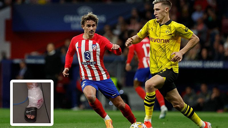 Griezmann acabó con el tobillo tocado tras jugar con el Dortmund - Champions League | Ver
