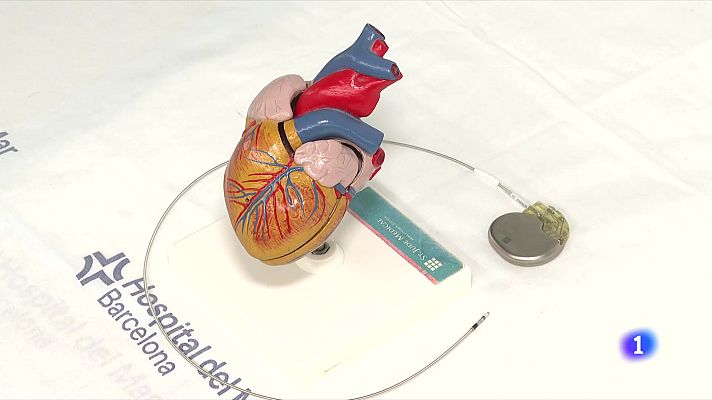 L'Informatiu - Canviar el punt d'estimulació del marcapassos dins del cor pot reduir complicacions