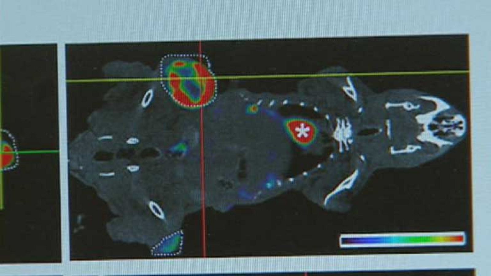 Científicos españoles descubren uno de los mecanismos que intervienen en la metástasis