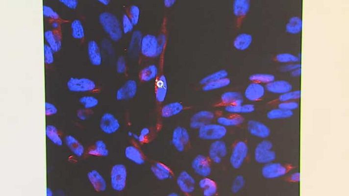 Telediario 1 - Proteínas que producen metástasis