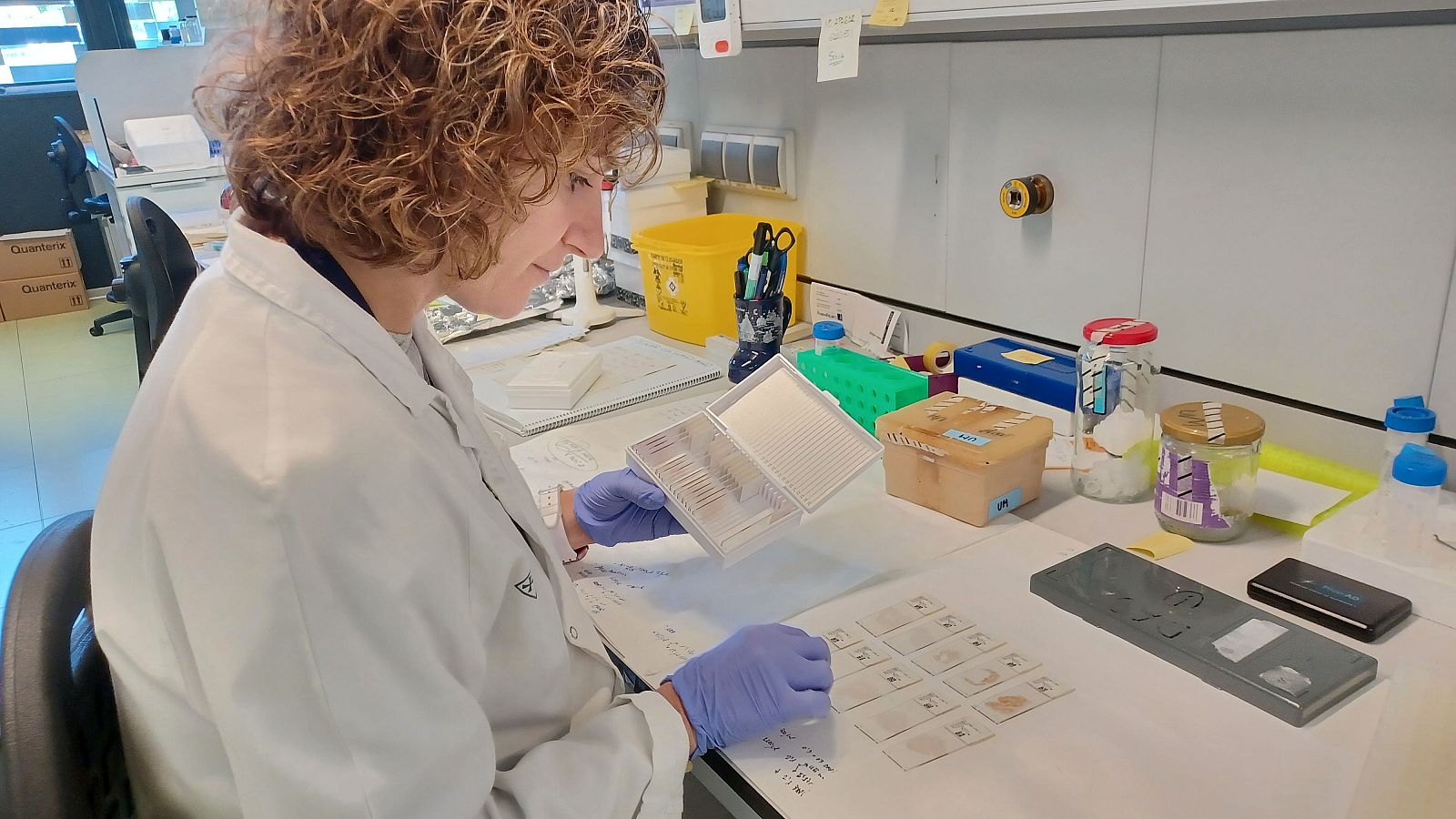 Descubren una nueva alteración genética que provoca el alzhéimer | Ver