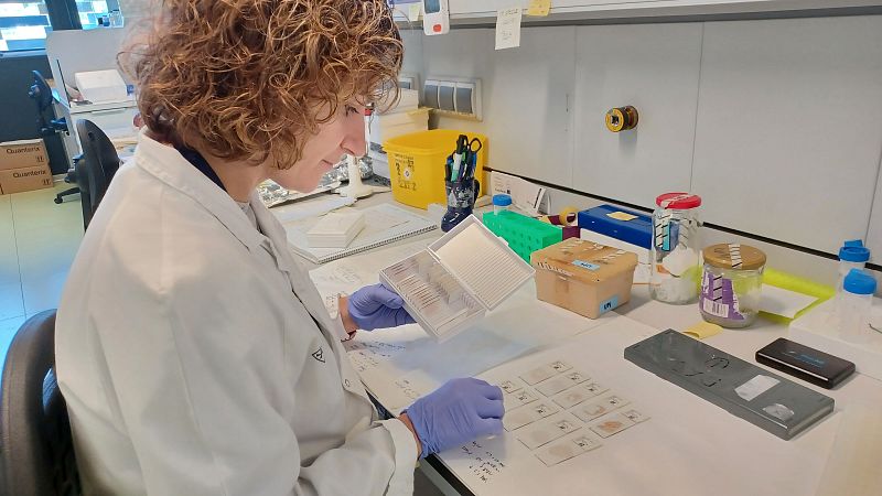 Descubren una nueva alteración genética que provoca el alzhéimer | Ver