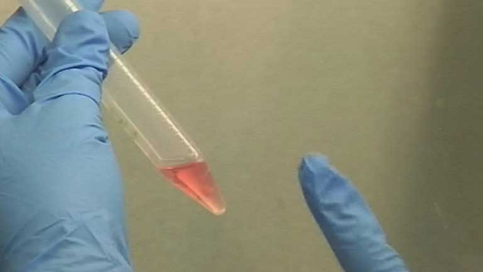 Científicos descubren cómo regenerar el cartílago dañado en pacientes con osteoartritis