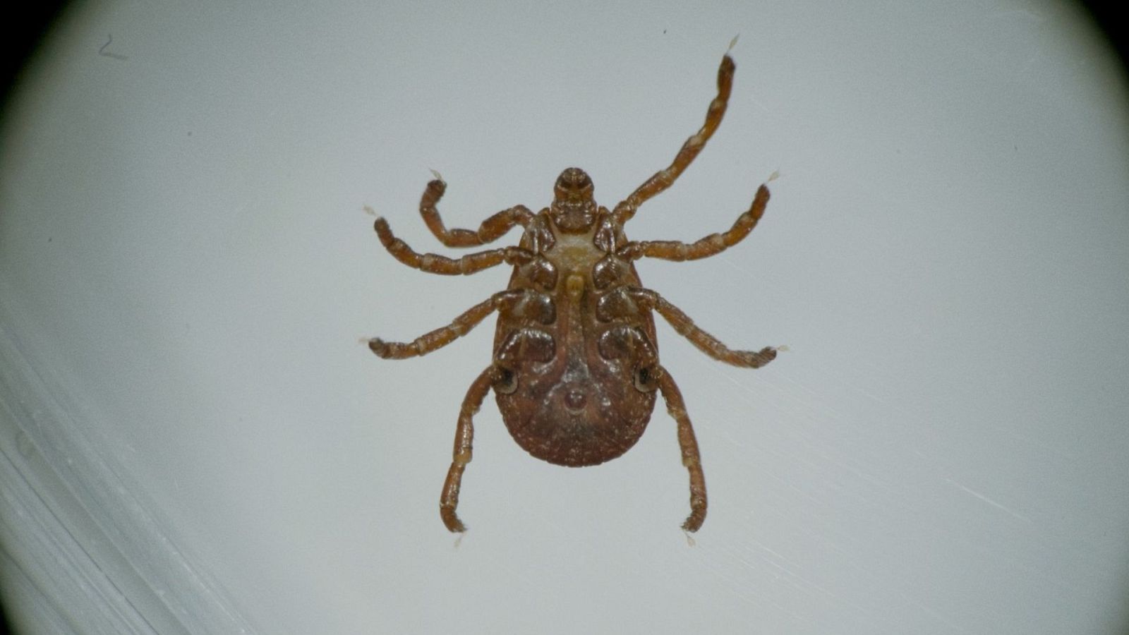 Documentos TV - La epidemia silenciosa - Ver ahora