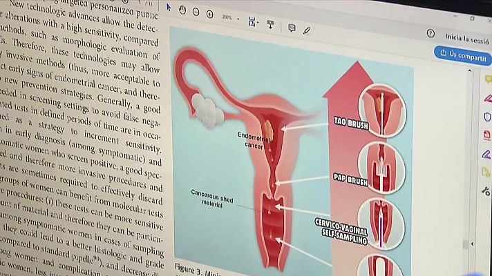 L'Informatiu - Només 149 baixes per menstruació incapacitant