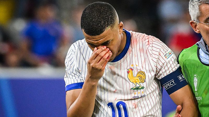 Mbappé se rompe la nariz al chocar contra el hombro de Danso - Eurocopa | Ver