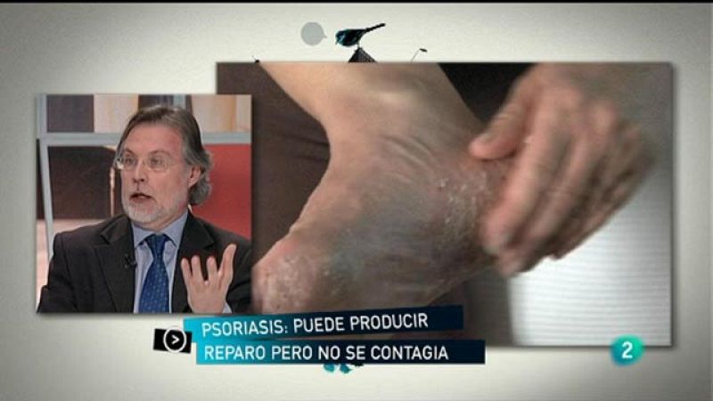 Para Todos La 2 - Debate: La psoriasis