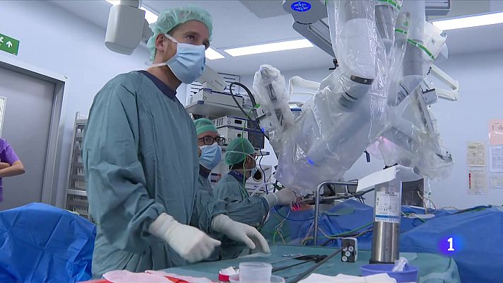L'Informatiu - Vall d'Hebron opera un tumor al paladar tou amb una tècnica pionera a l'Estat que combina robòtica i 3D