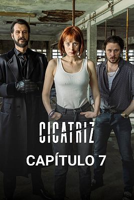 Cicatriz - Mi primer error