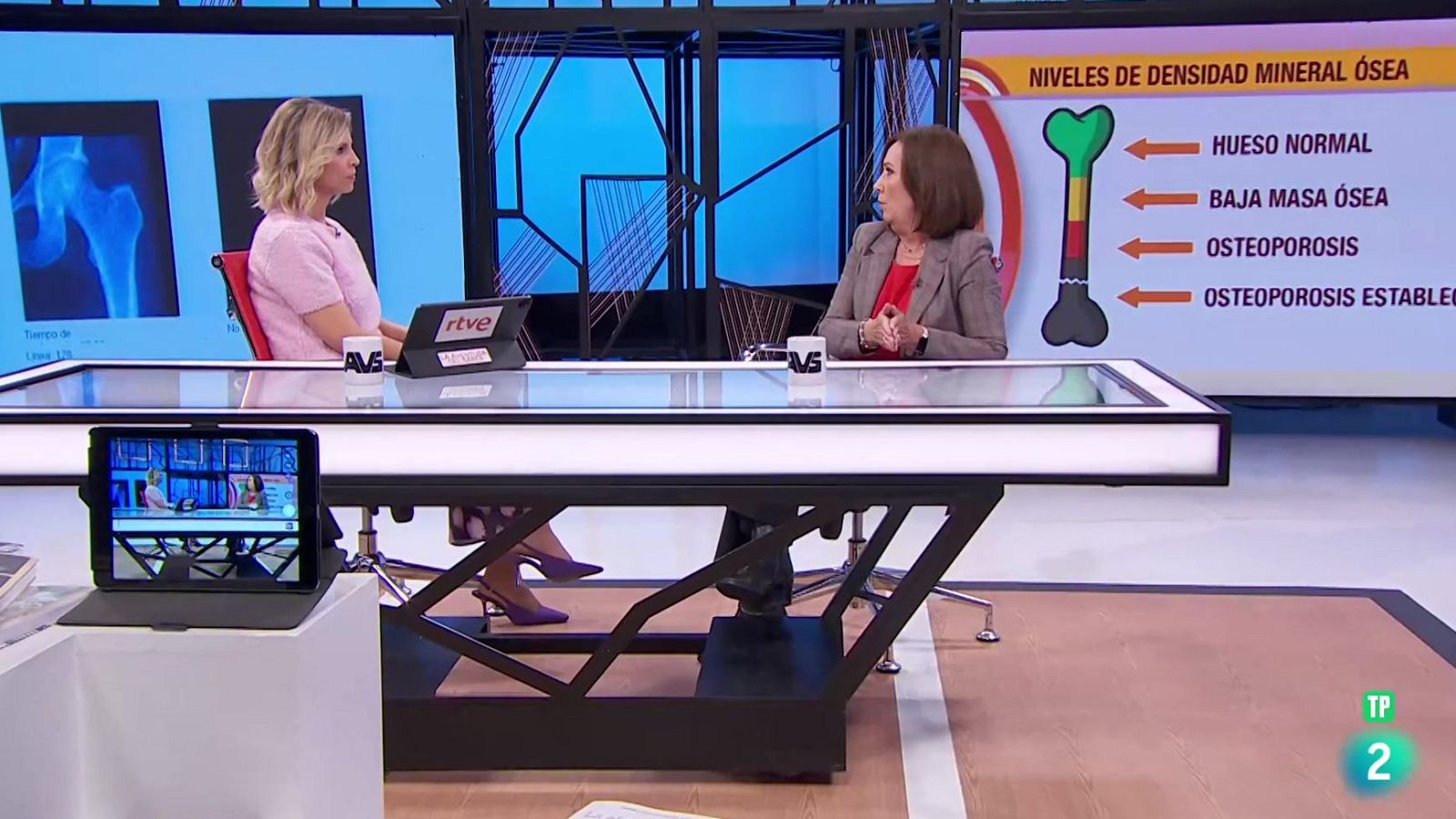 María Jesús Moro. La osteoporosis | Ver