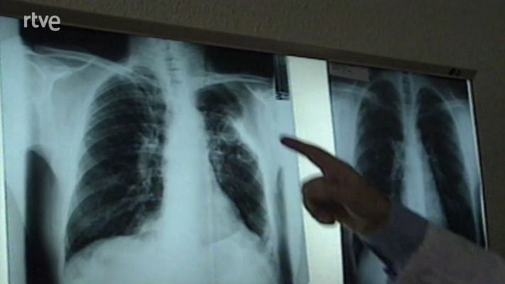 L'Informatiu - Els tècnics en Radiologia denuncien intrusisme professional