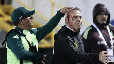 Javier Aguirre sufre un botellazo en la cabeza tras el Honduras - Mxico