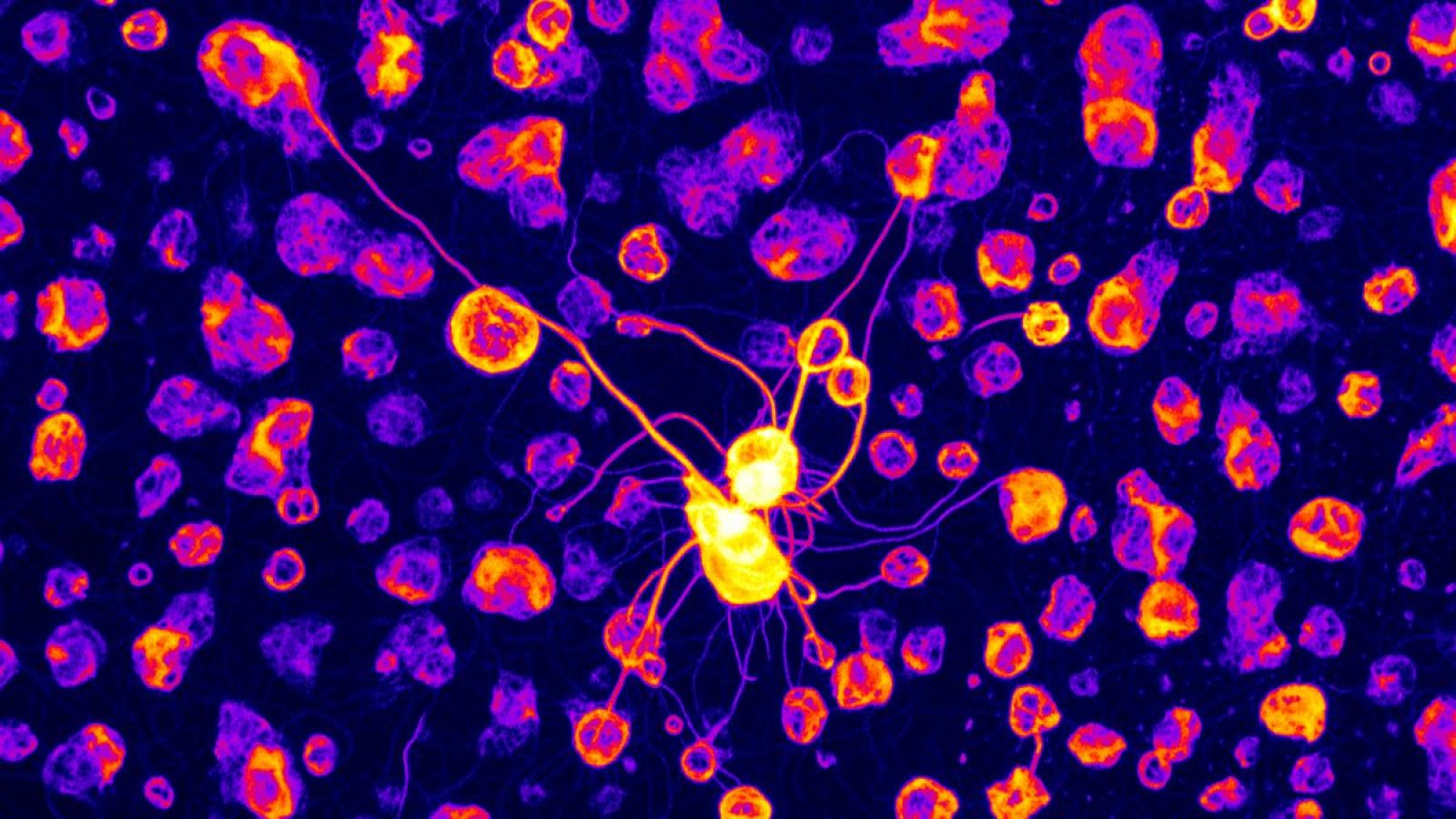 Un estudio de IRB Barcelona revela el papel crucial de unos genes en el autismo - Informativo 24h | Ver