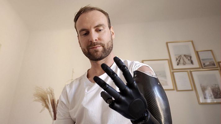 Somos Documentales - La mano extraordinaria: del tacto a la victoria