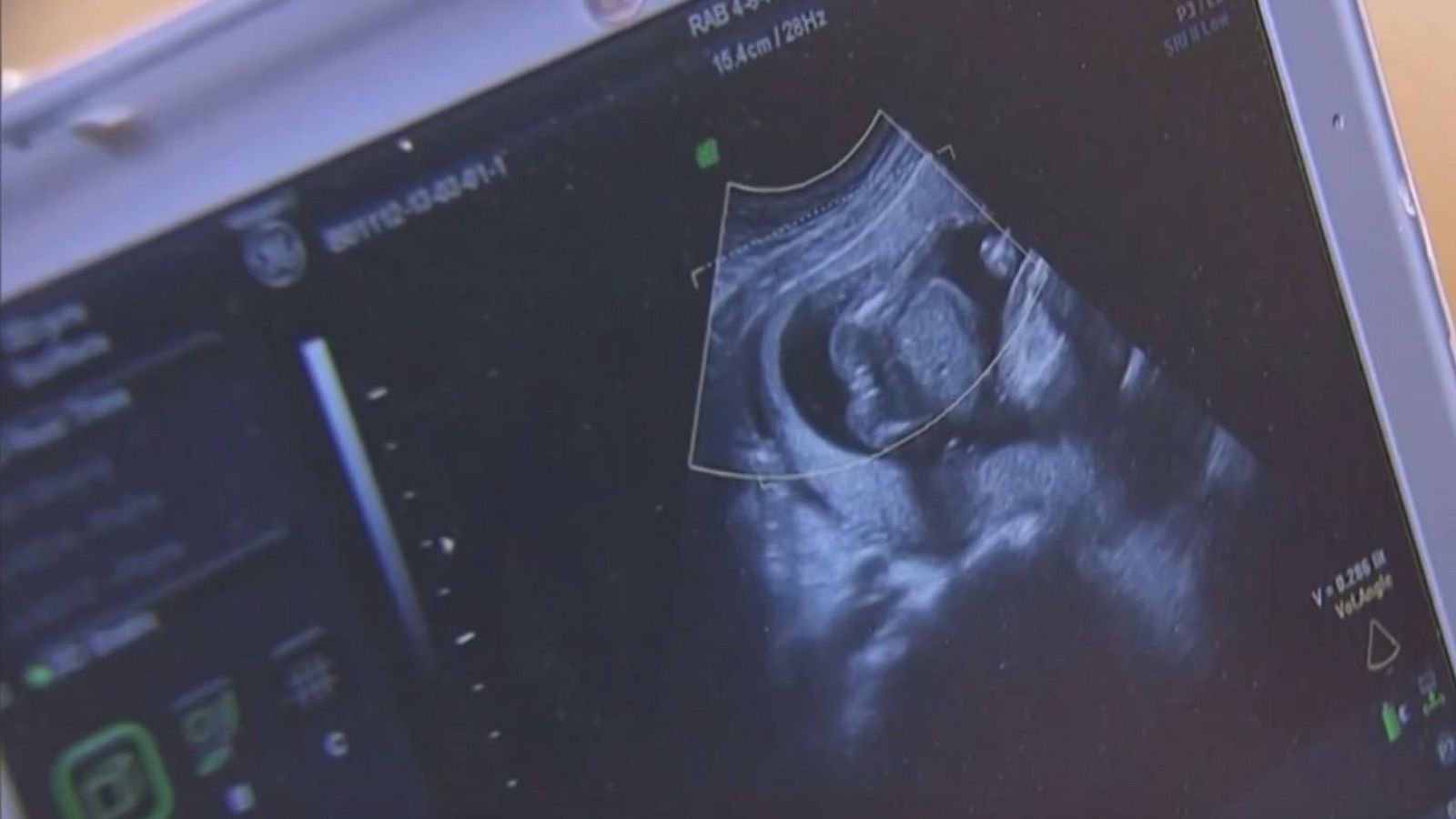 "Trump es responsable de las leyes antiabortivas" | Ver