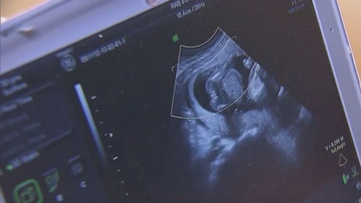 Telediario Fin de Semana - "No supimos trasladar que Trump es responsable de las leyes antiabortivas"