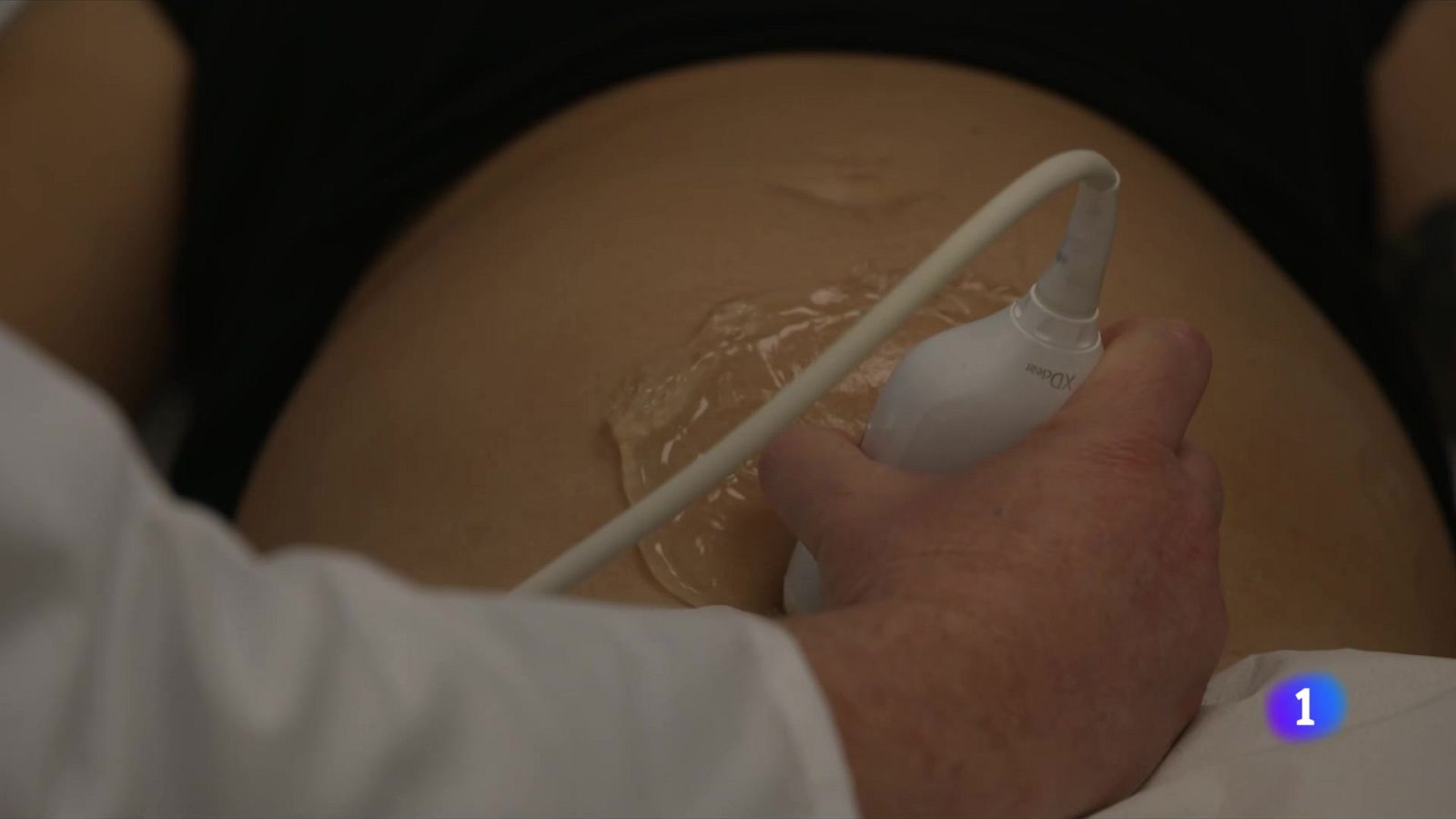 Un estudi de l'hospital Vall d'Hebron evita induccions del part innecessàries - L'Informatiu | Veure