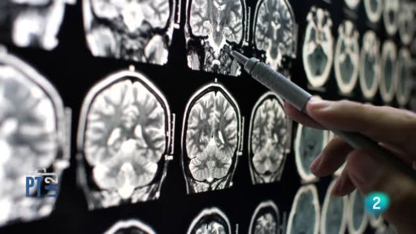 El cerebro y las emociones - Para todos La 2 | Ver