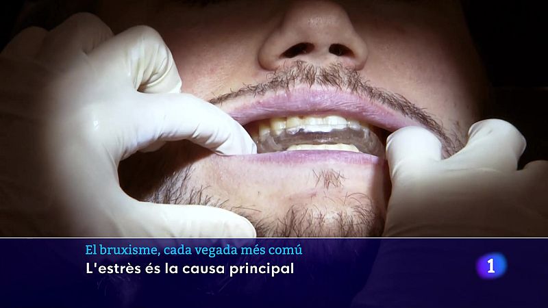 Mal de cap, oïdes i tensió a les galtes...el bruxisme, una afecció cada vegada més comú - L'Informatiu | Veure