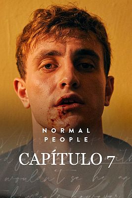 Normal people - Episodio 7
