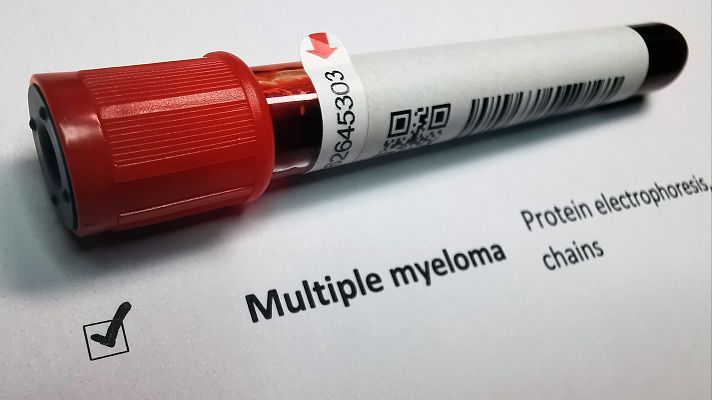 Telediario 1 - Éxito de la terapia CAR-T contra el cáncer