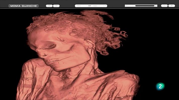 Telecanarias - Telecanarias 2 - 24/02/2025