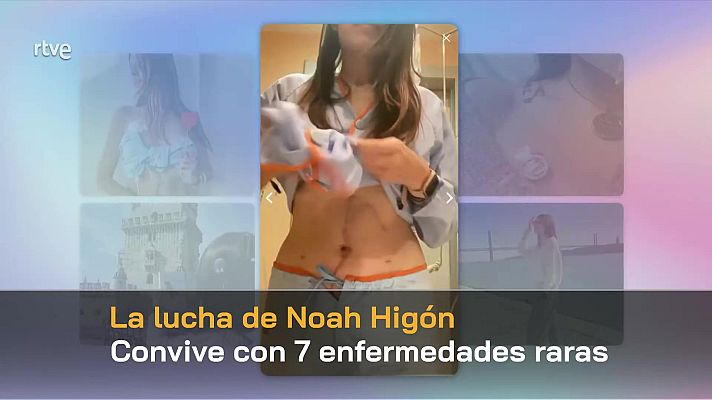 Parlamento - Parlamento - 01/03/25