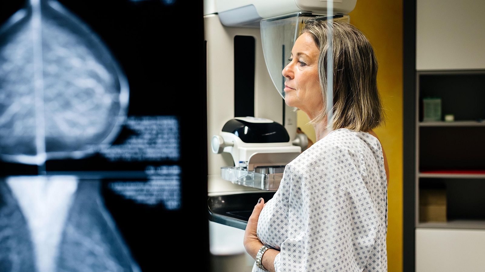 Polémica por limitar el tratamiento oncológico en la sanidad privada - La hora de La 1 | Ver