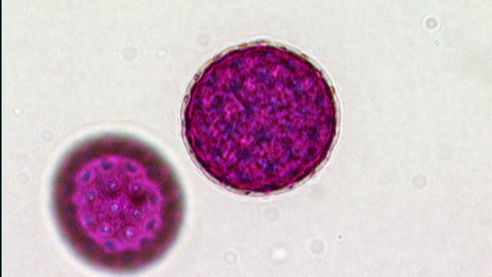 El escarabajo verde - El poder de lo diminuto - ver ahora