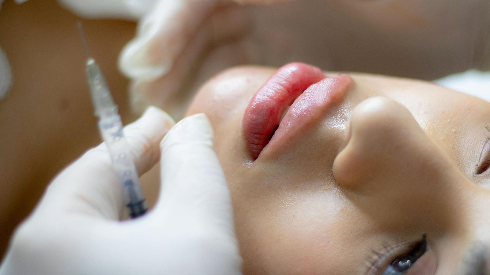 Laura Rojas-Marcos. La salud mental y la cirugía estética | Ver