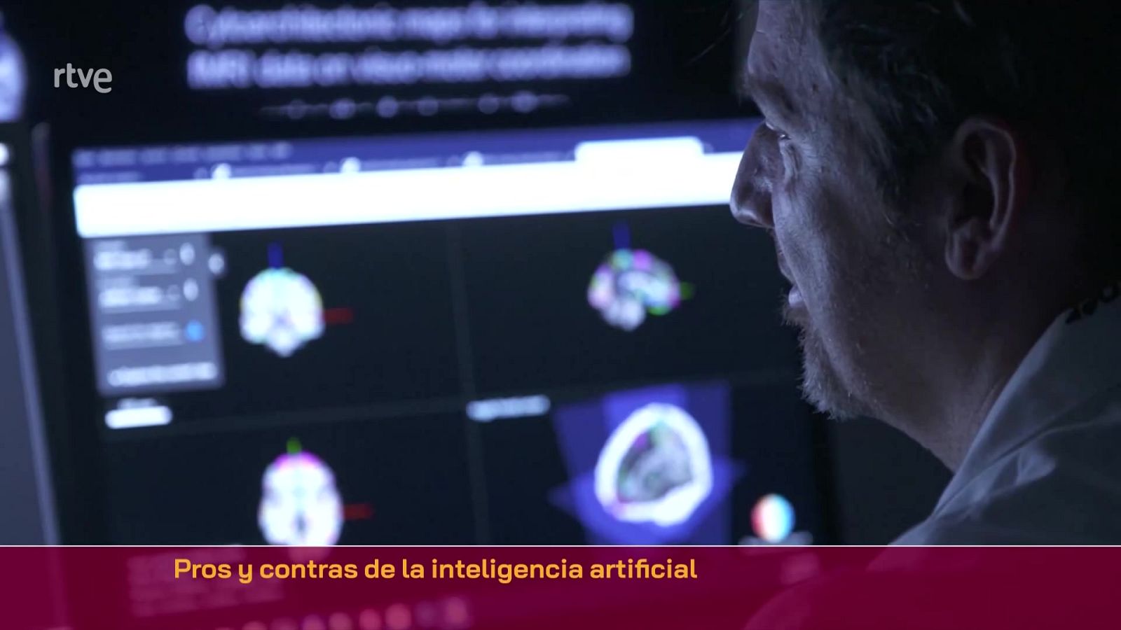 Inteligencia Artificial | Ver
