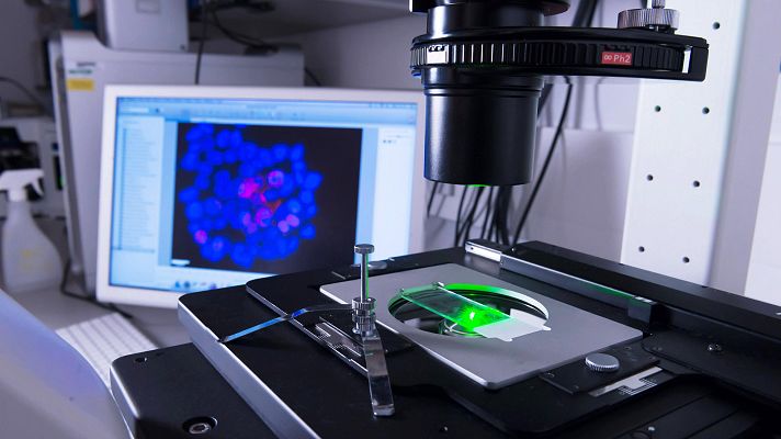 Telediario 1 - Dos prometedores avances para frenar el cáncer de páncreas