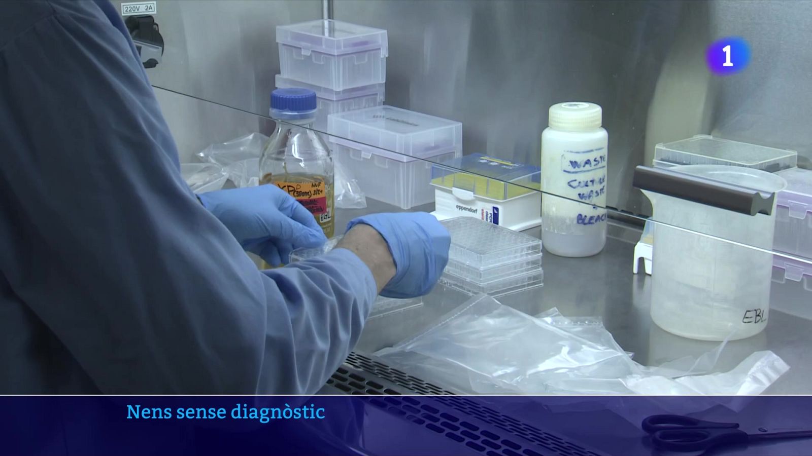 La meitat dels nens amb malalties rares estan sense diagnosticar - L'Informatiu | Veure