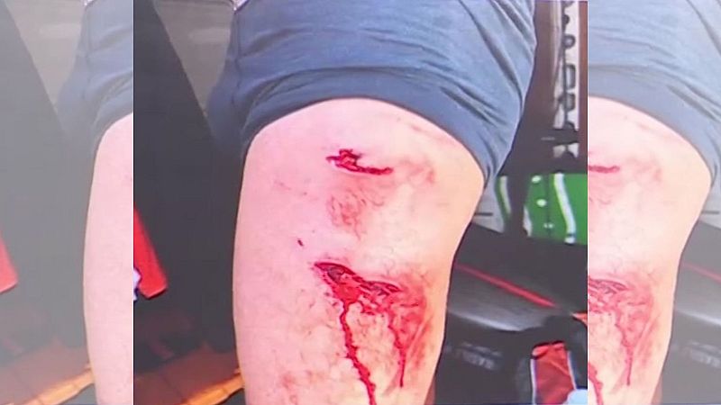 Ataque de un tiburón en Fuerteventura - Mañaneros 360 | Ver